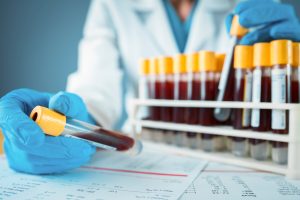 COVID-19: NCDC rCOVID-19: NCDC registers 49 new infectionsegisters 49 new infections