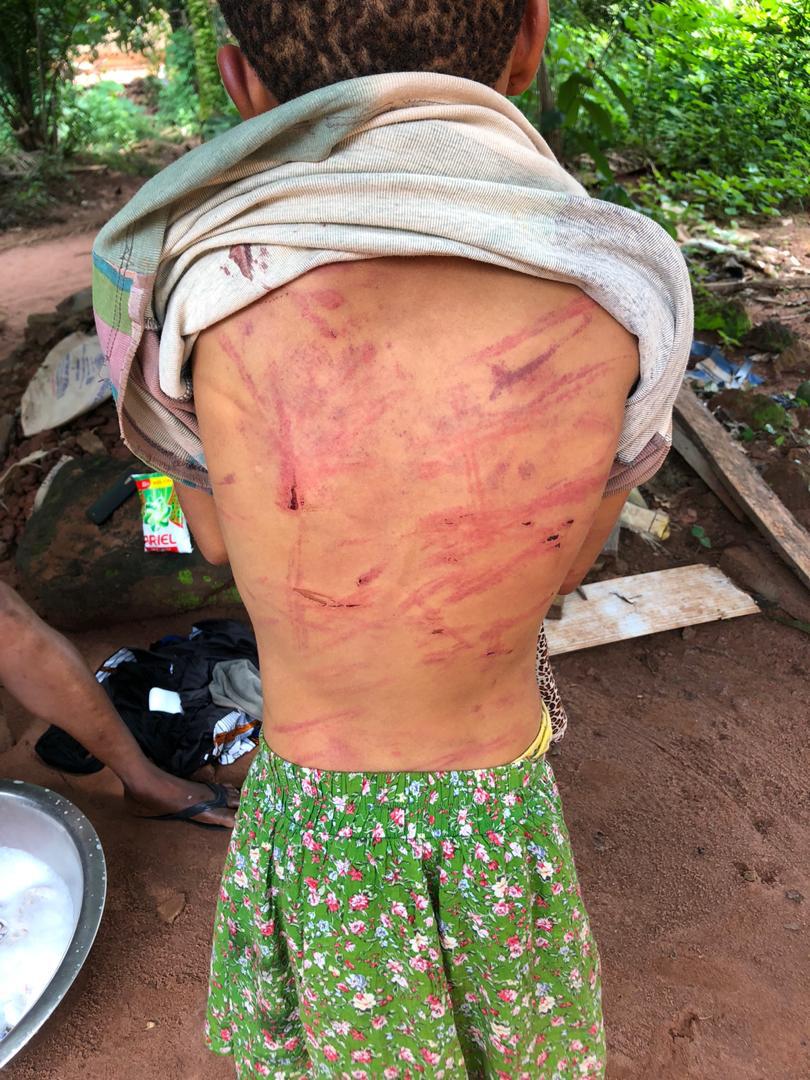 Another couple arrested for assaulting their 12-years old daughter