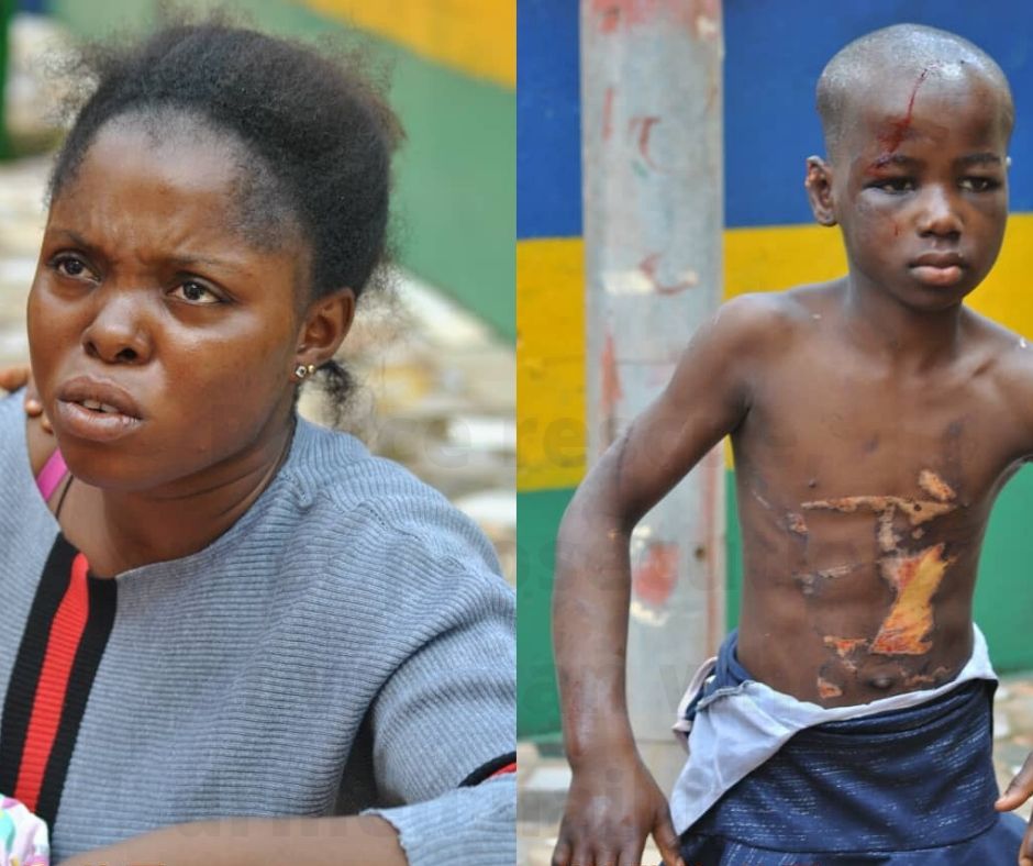 Police rescue, order prosecution of woman who drilled nail into the head of her housemaid