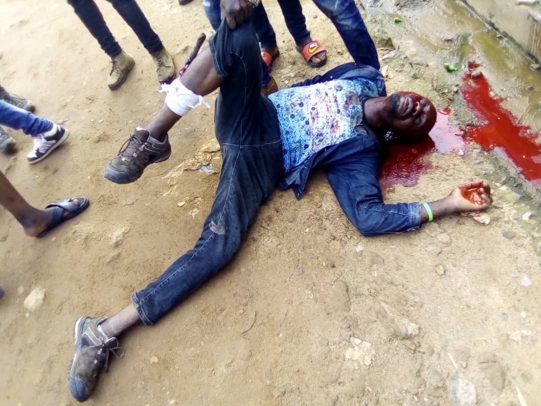 Ondo Poll: Thugs stab man with bottle at polling unit