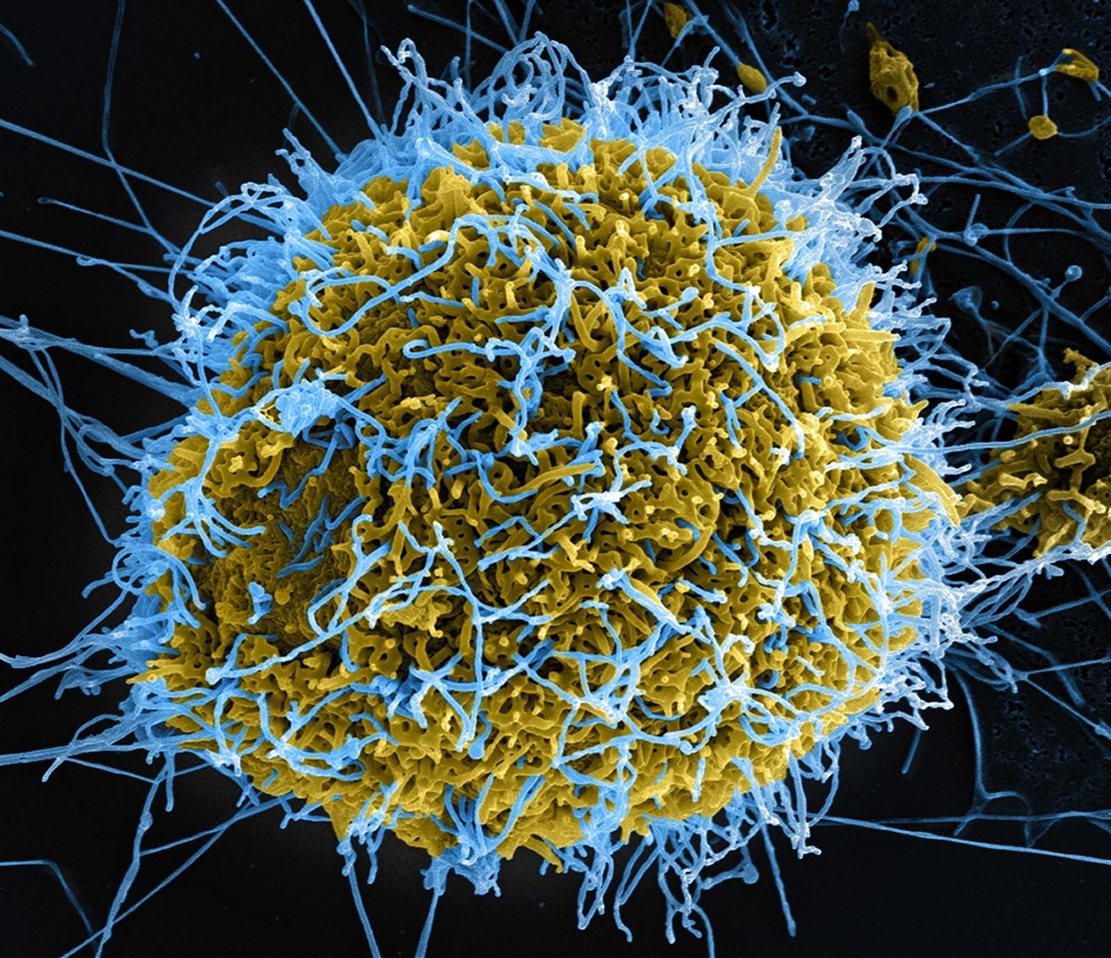 Public health experts caution Nigerians against Ebola rumours, misinformation - Phenomenal
